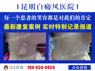 白癜风出现的原因有哪些?