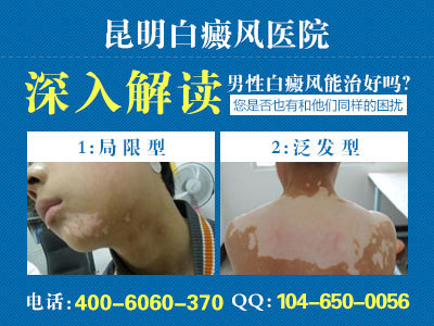 白癜风患者如何减压?