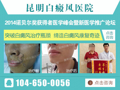 白癜风治疗能治疗好吗?