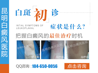 家里唯一的孩子得了白癜风怎么办?